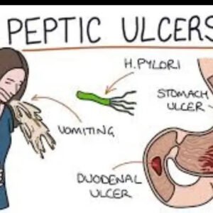 Package ya Kuanzia Kutibu Vidonda Vya Tumbo